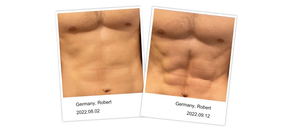 Professional Body Contouring Machine