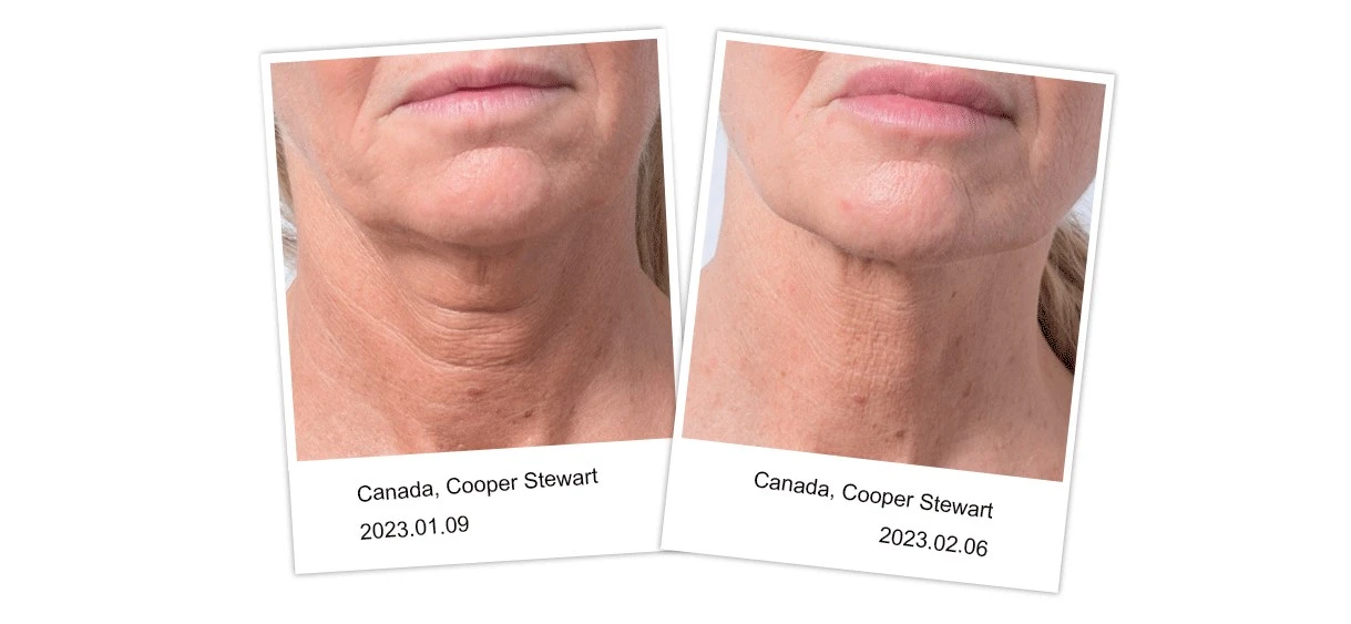 product-1219-563