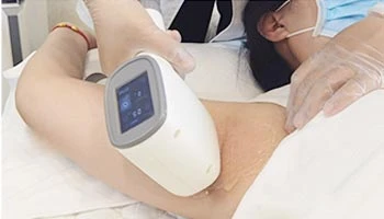 Steps For Laser Hair Removal