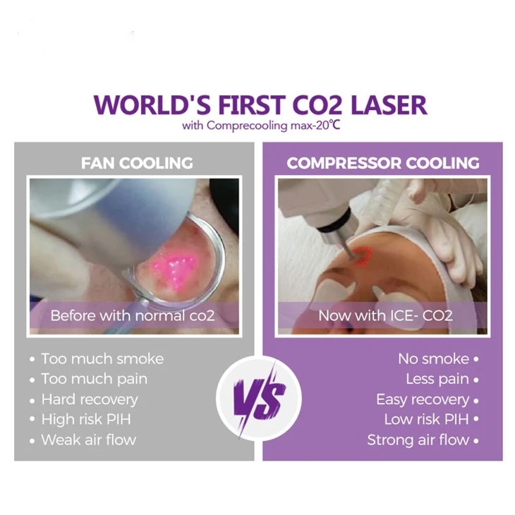 Co2 Fractional Laser Machine For Wrinkle factory