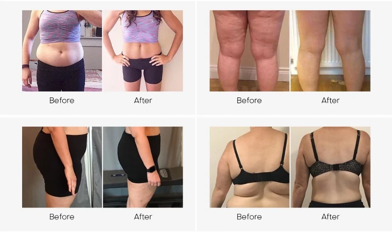 laser fat reduction machine 6 laser fat reduction machine 6