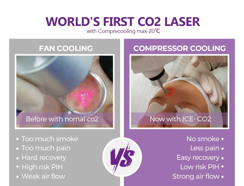 CO202 CO202