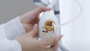What Are The Disadvantages Of Fractional CO2 Laser?