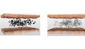 How Can I Permanently Remove Pigmentation From My Skin?
