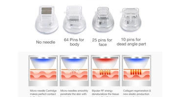 Does Radio Frequency Skin Tightening Work