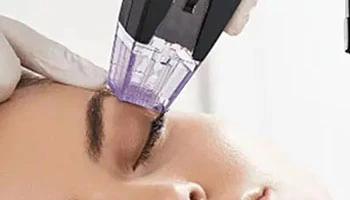 Is Radio Frequency Microneedling Safe