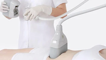 Cryo Slimming Before And After