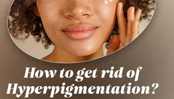 How To Get Rid Of Hyperpigmentation