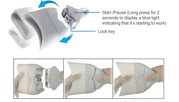 Cryolipolysis: The Future Of Fat Reduction