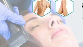 Radio Frequency Skin Tightening Before And After