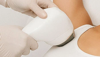 Why More Clinics Are Choosing In-House Laser Hair Removal Machines