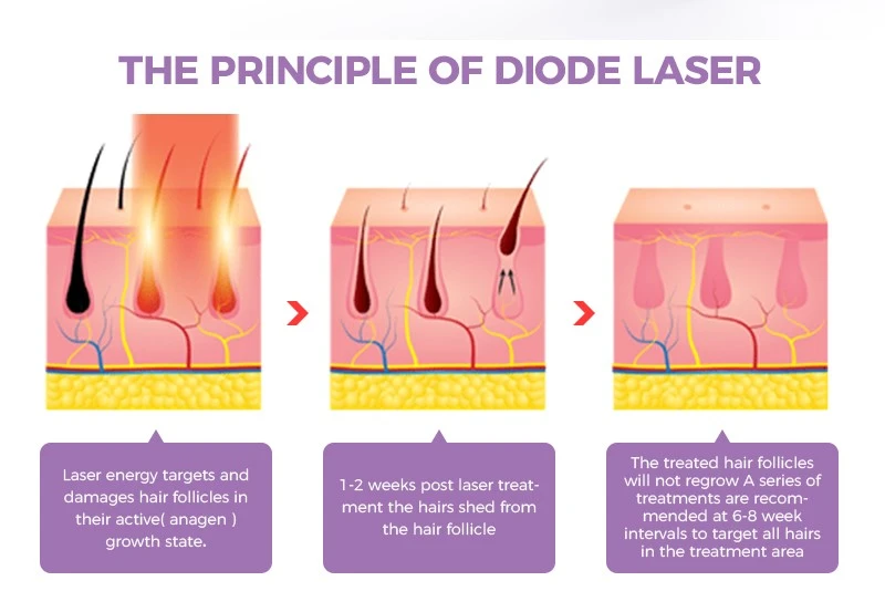 808NM Diode Laser And YAG Laser Machine 808NM Diode Laser And YAG Laser Machine