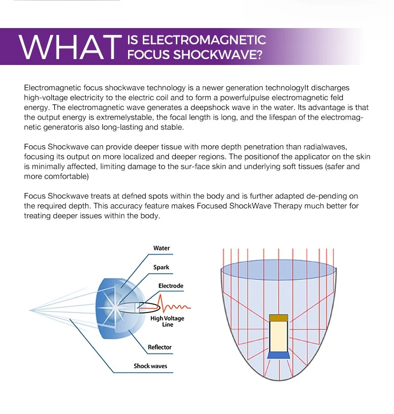 focused shockwave machine focused shockwave machine