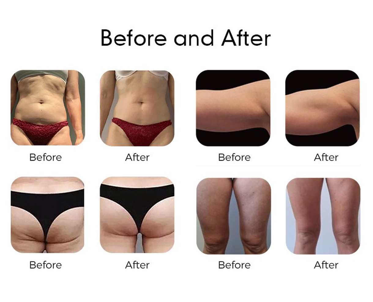 Professional Body Sculpting Machine Professional Body Sculpting Machine