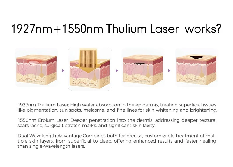 1550nm and 1927nm Dual-wavelength laser machine